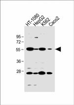 NTCP Antibody in Western Blot (WB)