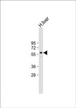 PPAR gamma Antibody in Western Blot (WB)