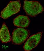 ALOX12 Antibody in Immunocytochemistry (ICC/IF)