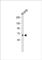 ALOX12 Antibody in Western Blot (WB)