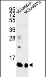 SPRR1B Antibody in Western Blot (WB)