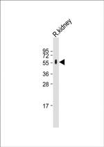 CYP27B1 Antibody in Western Blot (WB)