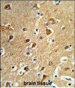 PPM1H Antibody in Immunohistochemistry (Paraffin) (IHC (P))