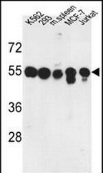 PPM1H Antibody in Western Blot (WB)