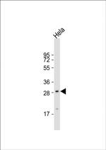 GCLM Antibody in Western Blot (WB)