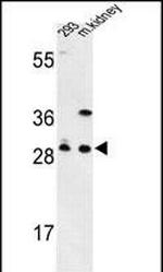 GCLM Antibody in Western Blot (WB)