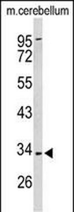 PEX2 Antibody in Western Blot (WB)