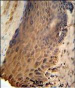 GFPT2 Antibody in Immunohistochemistry (Paraffin) (IHC (P))