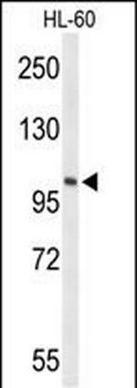 HSL Antibody in Western Blot (WB)