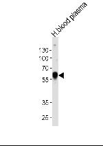 alpha-1 Antitrypsin Antibody in Western Blot (WB)