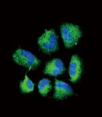 ChAT Antibody in Immunocytochemistry (ICC/IF)