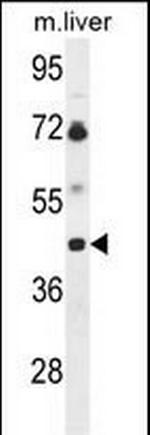 B3GNT5 Antibody in Western Blot (WB)