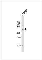 FOXG1 Antibody in Western Blot (WB)