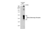 beta-2 Adrenergic Receptor Antibody in Western Blot (WB)