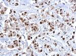 FOXA1 Antibody in Immunohistochemistry (Paraffin) (IHC (P))