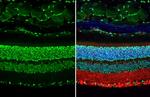 Rb Antibody in Immunohistochemistry (Paraffin) (IHC (P))