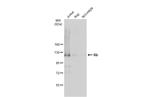 Rb Antibody in Western Blot (WB)