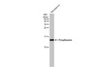 Transthyretin Antibody in Western Blot (WB)