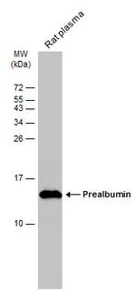 Transthyretin Antibody in Western Blot (WB)