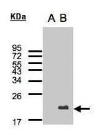 UBE2C Antibody in Western Blot (WB)