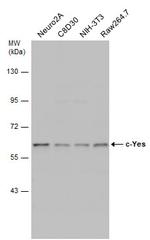 YES1 Antibody in Western Blot (WB)