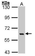 YES1 Antibody in Western Blot (WB)