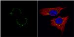 c-Met Antibody in Immunocytochemistry (ICC/IF)