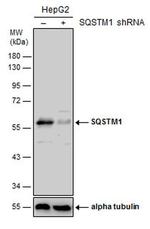 SQSTM1 Antibody