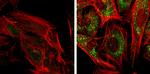 SQSTM1 Antibody in Immunocytochemistry (ICC/IF)