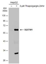 SQSTM1 Antibody in Western Blot (WB)