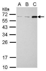 SQSTM1 Antibody in Western Blot (WB)