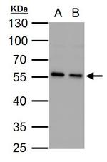 SQSTM1 Antibody in Western Blot (WB)