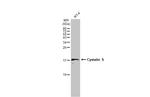 Cystatin S Antibody in Western Blot (WB)
