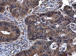 Syk Antibody in Immunohistochemistry (Paraffin) (IHC (P))