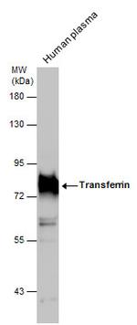 Transferrin Antibody in Western Blot (WB)