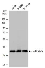 EIF2S1 Antibody in Western Blot (WB)