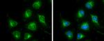 DLD Antibody in Immunocytochemistry (ICC/IF)