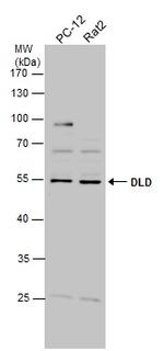 DLD Antibody in Western Blot (WB)