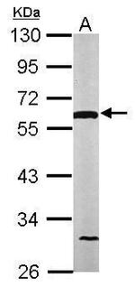 DLD Antibody in Western Blot (WB)