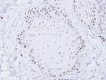 Blooms Syndrome Antibody in Immunohistochemistry (Paraffin) (IHC (P))