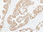 ADCY2 Antibody in Immunohistochemistry (Paraffin) (IHC (P))