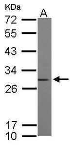 RhoGDI Antibody in Western Blot (WB)