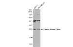 CK2 beta Antibody in Western Blot (WB)