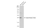 CK2 beta Antibody in Western Blot (WB)