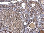 CK2 beta Antibody in Immunohistochemistry (Paraffin) (IHC (P))