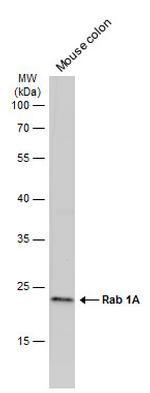 RAB1A Antibody in Western Blot (WB)