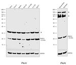 RAB1A Antibody in Western Blot (WB)