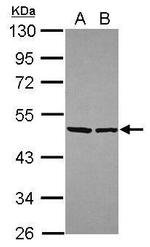 eIF4A2 Antibody in Western Blot (WB)