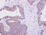 H6PD Antibody in Immunohistochemistry (Paraffin) (IHC (P))