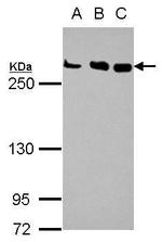 CHD4 Antibody in Western Blot (WB)
